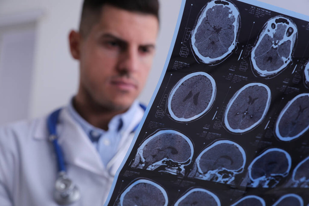 Doctor examining MRI images of patient with multiple sclerosis in clinic, closeup - Фото, зображення