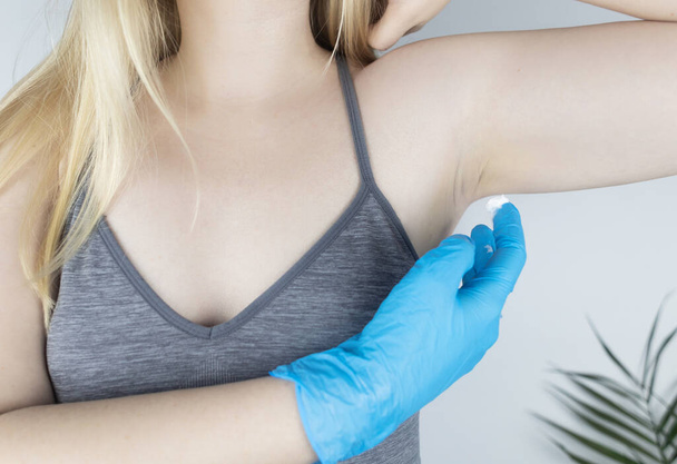 Girl in a blue medical glove smears a cream with botulinum toxin under her armpit. Novelty in cosmetology and medicine. Replacement of injection therapy. Painless treatment for excessive sweating. - Photo, Image