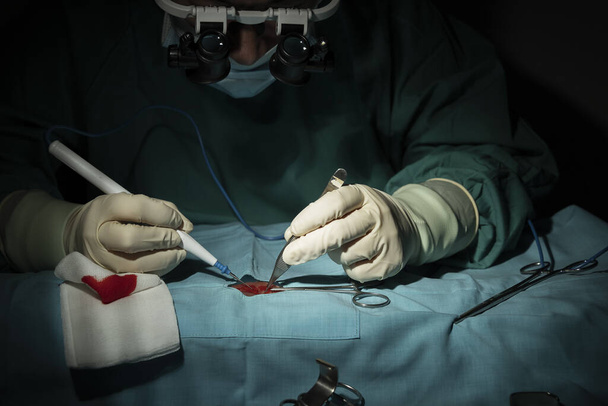 Vrouwelijke chirurg voert een micro-operatie uit aan één arm - Foto, afbeelding