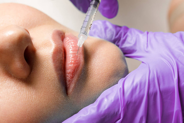 Увеличение и коррекция губ в косметологическом салоне. Специалист делает инъекцию в губы пациента. - Фото, изображение