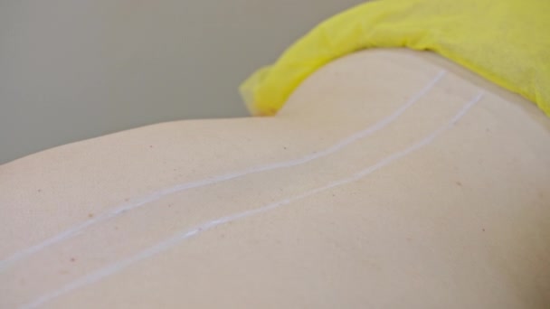 Beauty and injection concept. Cosmetology in the clinic. An experienced beautician wearing white gloves injects subcutaneous injections with the necessary active ingredients into the womans back for - Footage, Video