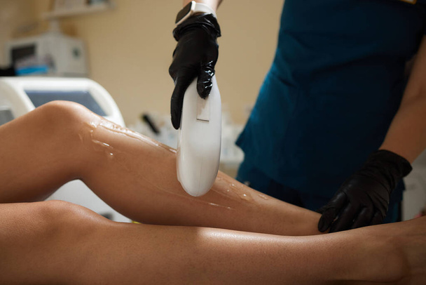 photo epilation - close up of hair removal procedure on legs in salon. - Valokuva, kuva