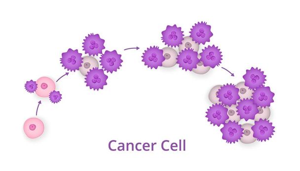 Process of development of cancer cells - Vector, Image