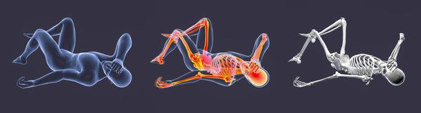 Ανθρώπινο ανδρικό σώμα σε κακή θέση συναίσθημα, 3D εικόνα. Ένα σύνολο σωμάτων με και χωρίς τονισμένο σκελετό και απομονωμένο ανθρώπινο σκελετό. Έννοια των οδυνηρών συναισθημάτων στο σώμα, καρδιακή προσβολή - Φωτογραφία, εικόνα