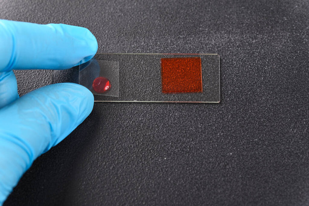 Duas gotas de líquido vermelho na lâmina do microscópio. - Foto, Imagem