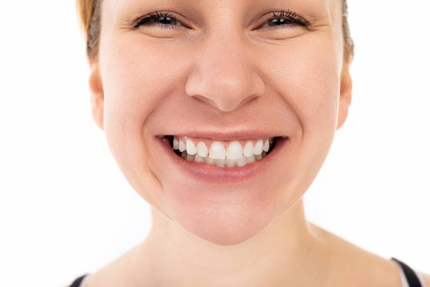 close-up portrait of a beautiful young middle-aged woman with a snow-white smile - Photo, Image