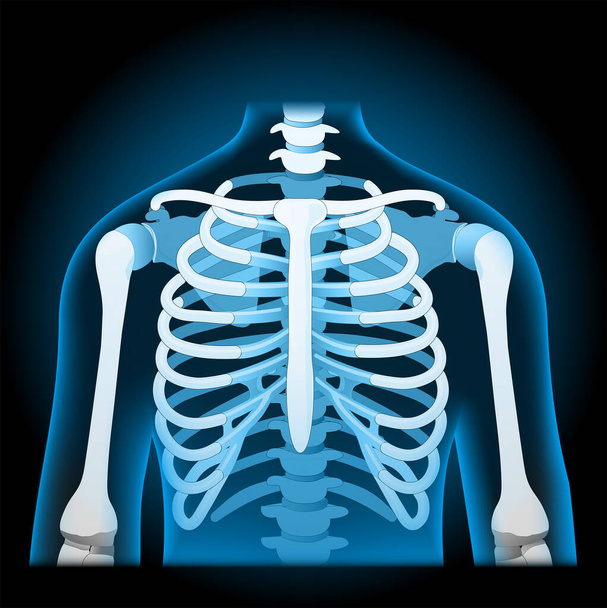 Menselijke ribbenkast. röntgenblauwe, realistische romp. Menselijk silhouet op donkere achtergrond. Vector poster gemakkelijk te bewerken - Vector, afbeelding