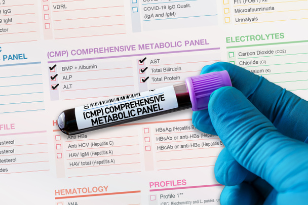 Bloedmonsterbuis voor analyse van CMP Comprehensive Metabolic Panel in laboratorium. Bloedbuistest met aanvraagformulier voor uitgebreide CMP-stofwisselingstests - Foto, afbeelding