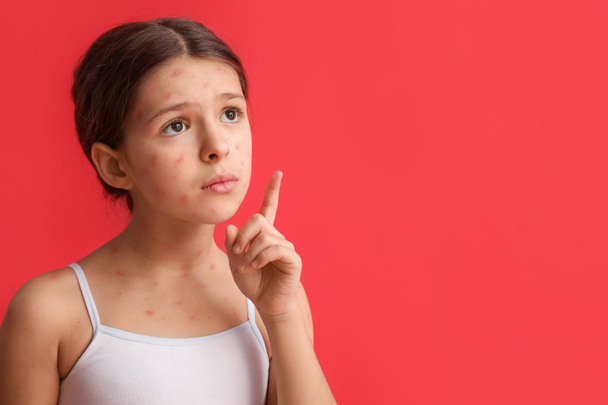 Petite fille malade avec la varicelle pointant quelque chose sur fond rouge - Photo, image