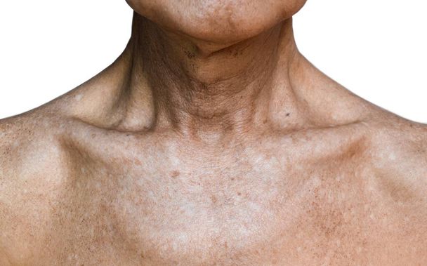 Alternde und faltige Haut an der Brust eines südostasiatischen, chinesischen alten Mannes. - Foto, Bild