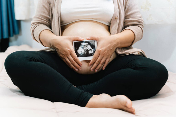 Eine Schwangere in einem Kleid mit Ultraschallbild. Werdende Mutter wartet und bereitet sich während der Schwangerschaft auf die Geburt vor.  - Foto, Bild