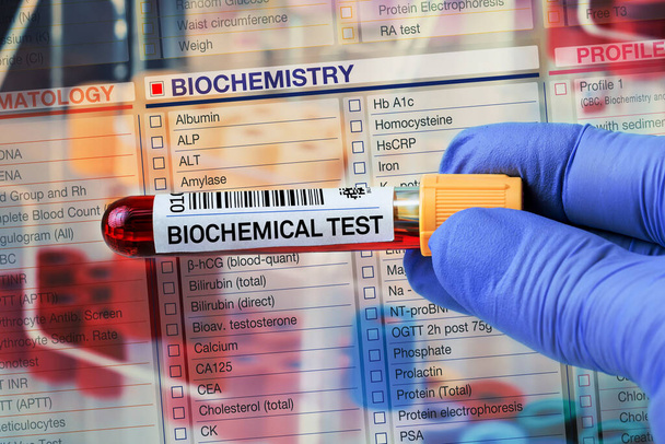 Tube d'échantillon de sang pour l'analyse du profil biochimique en laboratoire. Test en tube sanguin avec formulaire de demande pour test biochimique - Photo, image