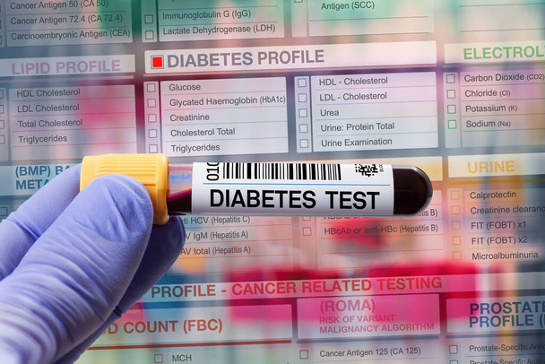 Verinäytteen putki analysoimiseksi Diabetes profiilin testi laboratoriossa. Veriputkitesti diabetestestiä varten vaaditulla lomakkeella  - Valokuva, kuva
