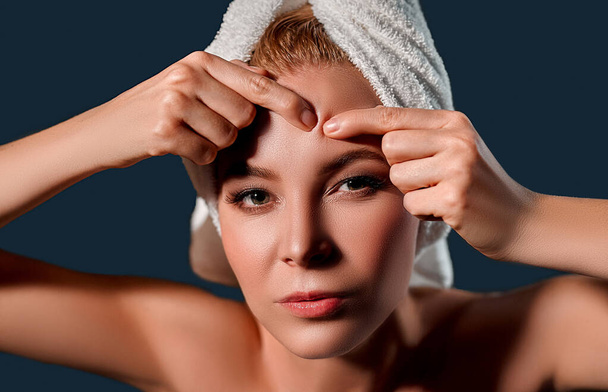 Portrait of a young attractive woman with a towel on her head squeezes acne isolated on a gray background. Skin care concept. - Photo, Image