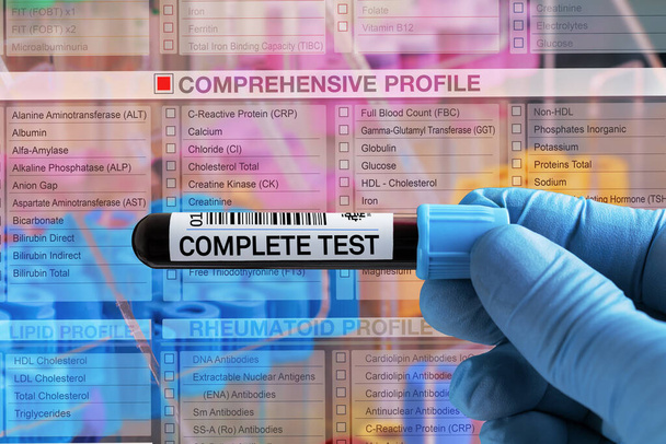 Tubo del campione di sangue per l'analisi del test completo del profilo in laboratorio. Test del tubo sanguigno con modulo di richiesta per l'esame del sangue completo - Foto, immagini