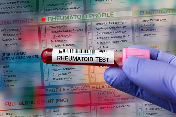 Tubo campione di sangue per l'analisi del test del profilo reumatoide in laboratorio. Prova del tubo sanguigno con modulo di requisizione per il test reumatoide - Foto, immagini