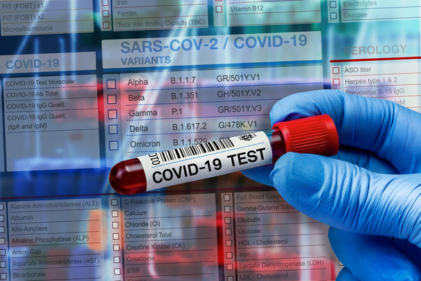 Σωλήνας δείγματος αίματος για ανάλυση της δοκιμής προφίλ παραλλαγής Covid-19 στο εργαστήριο. Δοκιμή σωλήνα αίματος με αίτηση για το Covid-19 Coronavirus test - Φωτογραφία, εικόνα