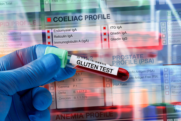 Bloedmonsterbuis voor analyse van coeliakie- en glutenprofieltest in laboratorium. Bloedbuistest met aanvraagformulier voor coeliakie - Foto, afbeelding