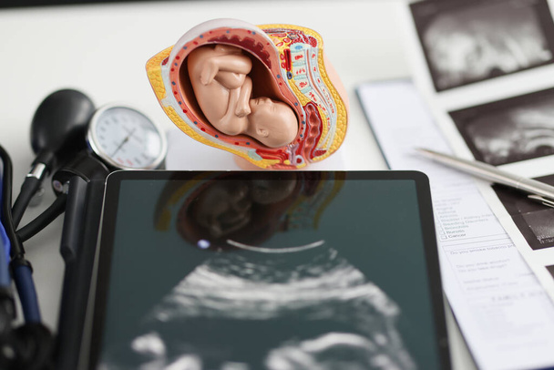 子宮と超音波付きタブレットをテーブルの上にモデル化 - 写真・画像