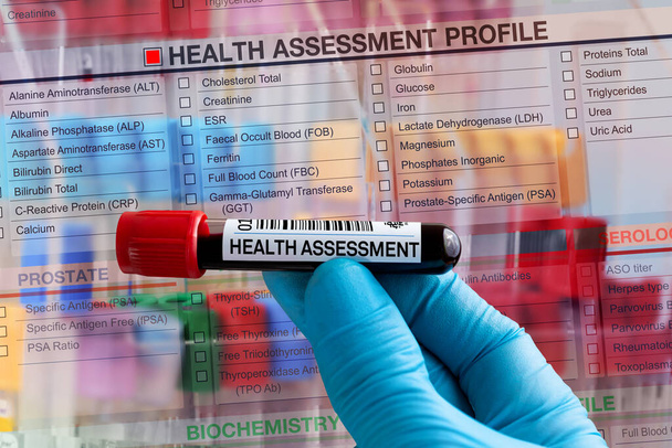 Blutprobenröhrchen zur Analyse von Gesundheitsbeurteilungen im Labor. Blutröhrchen-Test mit Anforderungsformular für Health Assessment Test für Männer - Foto, Bild