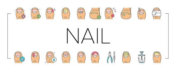 Ingrown nail Disease Collection Icons Set Vector . - Vektor, obrázek