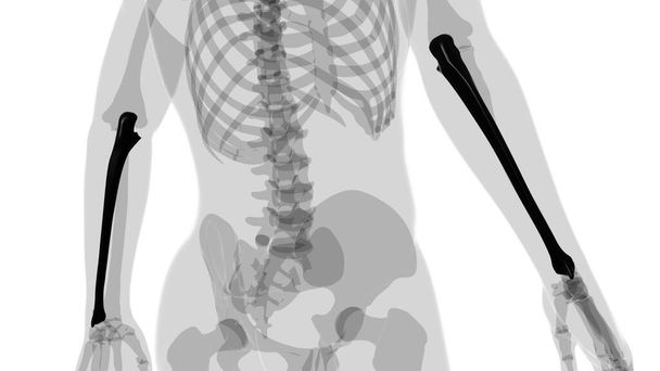 Human skeleton anatomy Ulna Bone 3D Rendering For Medical Concept - Photo, Image