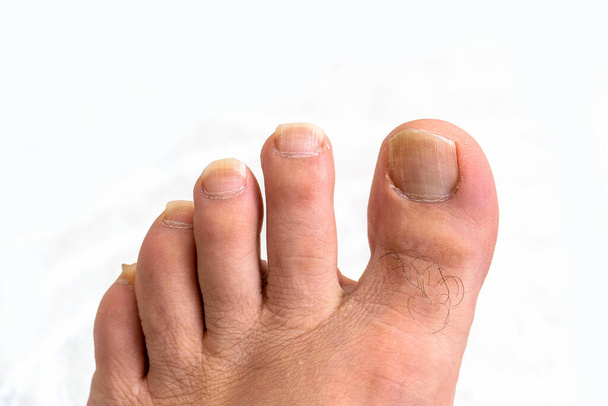 Both hand and foot nail care should be done periodically. This is important not only in terms of health but also in terms of appearance. Nails should be cut within a certain time in order to obtain a clean and beautiful appearance and to maintain hea - Photo, Image