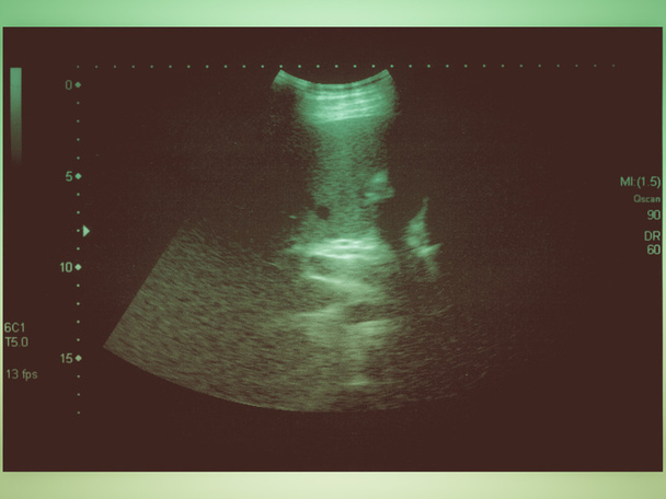 Look retrò Scansione ad ultrasuoni
 - Foto, immagini