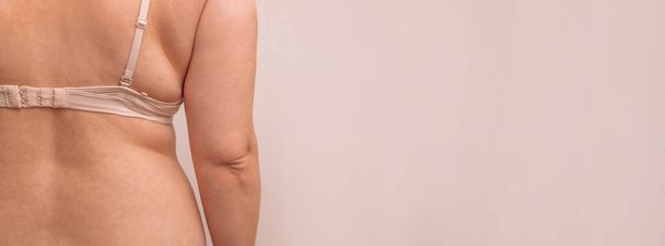 Dikke kant, mollige, zwaarlijvige vrouw met cellulitis vouw aan de zijkanten, vrouw dieet levensstijl concept met kopieerruimte - Foto, afbeelding