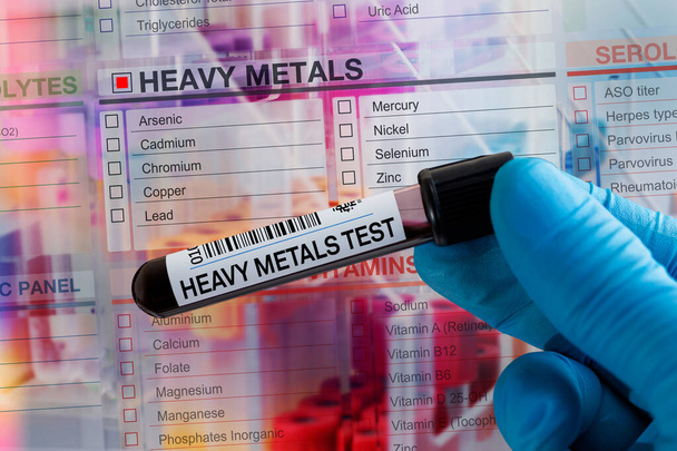 Bloedmonster buis voor analyse zware metalen in het laboratorium. Bloedbuistest met aanvraagformulier voor de test op zware metalen - Foto, afbeelding