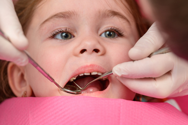 Ένα μικρό κορίτσι κάθεται σε μια οδοντιατρική καρέκλα προετοιμασμένη για τη διαδικασία, το παιδί έχει μια ποδιά στο στήθος του από τη βρωμιά, το παιδί είναι έτοιμο για οδοντιατρικές επεμβάσεις. - Φωτογραφία, εικόνα