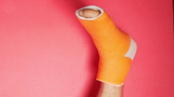 Fuß mit gebrochenem Zehenknochen in orangefarbenem Fiberglas gegossen rosa Hintergrund. Verletzte gebrochene geschwollene männliche Bein in modernen orthopädischen wasserdichten Guss aus synthetischem thermoplastischem Glasgewebe Patientenkörper 4K - Filmmaterial, Video