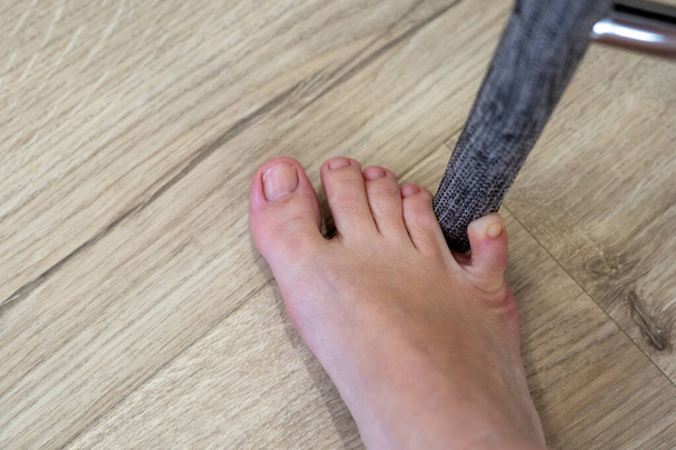 Una mujer golpeó muebles con el dedo meñique. Incidente en casa. Lesión del dedo meñique del pie - Foto, Imagen