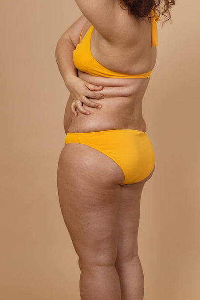 Cropped image of overweight fat woman with obesity hips, excess fat in yellow swimsuit.Holding waist flabs. Liposuction - Foto, immagini