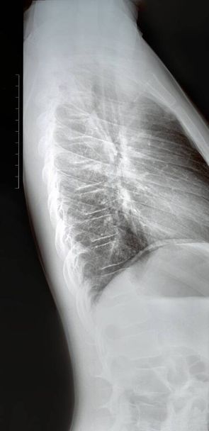 Raggi X della colonna vertebrale per l'esame da parte di un medico. Fratture, lesioni o curvatura della schiena. Il concetto di medicina e scienza. - Foto, immagini