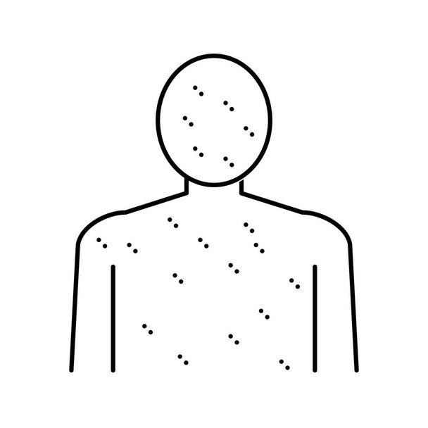 erupção cutânea cor do corpo inteiro ícone vetor ilustração - Vetor, Imagem