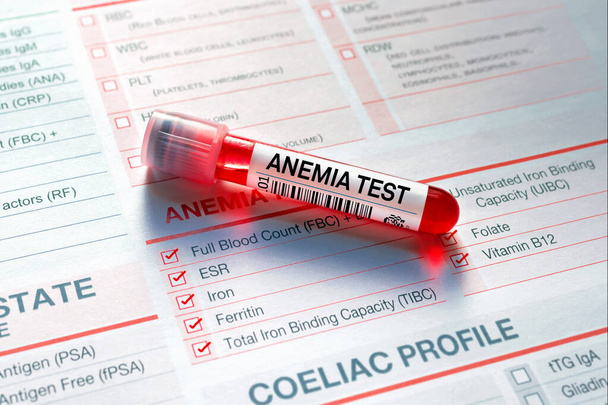 Teste de tubo sanguíneo com formulário de requisição para teste de anemia. Amostra de sangue para análise do teste de perfil de anemia em laboratório - Foto, Imagem