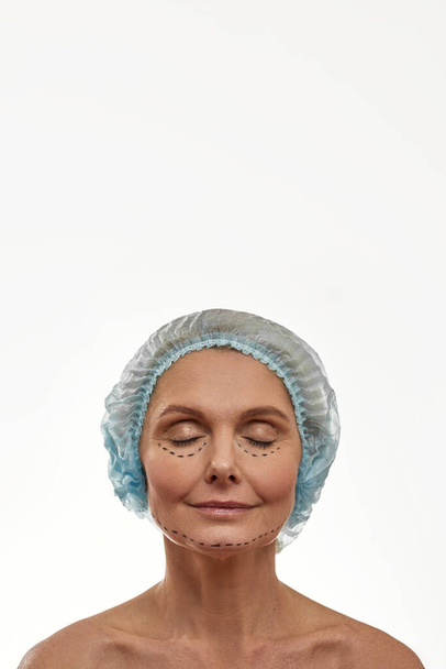 Adult woman with puncture lines on her face - Zdjęcie, obraz