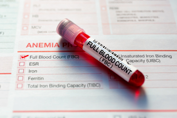Τεστ αίματος με αίτηση για γενική εξέταση αίματος για γενική εξέταση αίματος. Δείγμα αίματος για ανάλυση Full Blood Count FBC στο εργαστήριο - Φωτογραφία, εικόνα