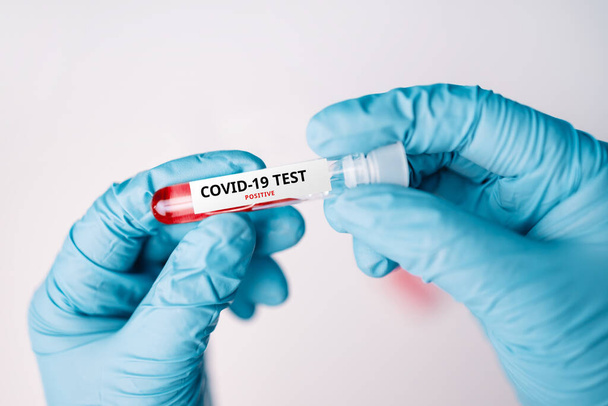 Closeup of doctor in blue gloves holding new Covid-19 swab test tube in analysis lab - Φωτογραφία, εικόνα