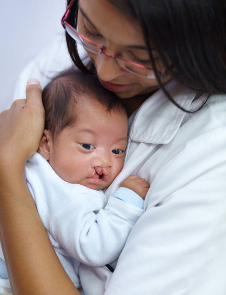 Dar consuelo es clave en su profesión. Fotografía de una joven enfermera sosteniendo a un bebé que tiene un paladar hendido. - Foto, Imagen