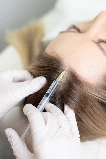 mesoterapia dei capelli sulla testa di una ragazza. cosmetologia - Foto, immagini
