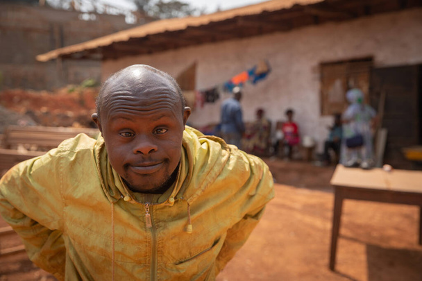 Portret Afrykanina z zespołem Downa w afrykańskiej wiosce. - Zdjęcie, obraz