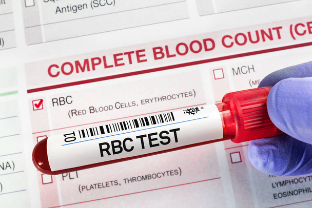 Σωλήνας δείγματος αίματος για ανάλυση του FBC RBC Πλήρης δοκιμή προφίλ ερυθρών αιμοσφαιρίων στο εργαστήριο. Δοκιμή σωλήνα αίματος με αίτηση για RBC Πλήρης εξέταση ερυθρών αιμοσφαιρίων   - Φωτογραφία, εικόνα