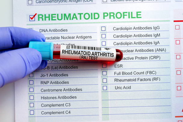 Blood sample tube for analysis of Rheumatoid Arthritis RA profile test in laboratory. Blood tube test with requisition form for RA Rheumatoid Arthritis test - Photo, Image