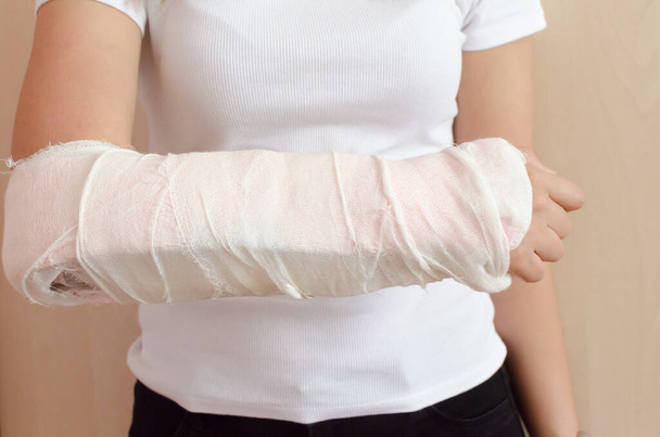 bandagem de gesso no braço direito das mulheres no interior. Foto de alta qualidade - Foto, Imagem