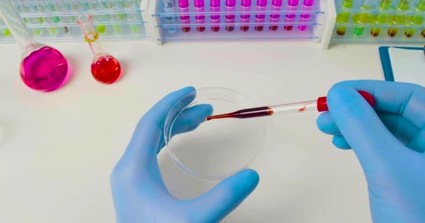 Βίντεο 4k close-up - γιατρός στάζει ένα δείγμα μολυσμένου αίματος σε ένα τρυβλίο Petri για την έρευνα. - Πλάνα, βίντεο