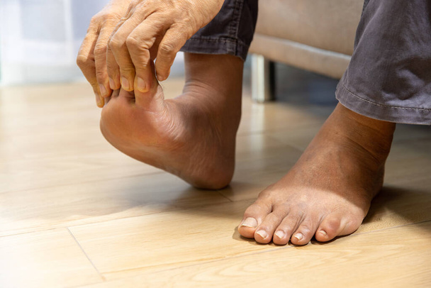Senior Man μασάζ πόδι με επώδυνη φλεγμονή της ουρικής αρθρίτιδας - Φωτογραφία, εικόνα