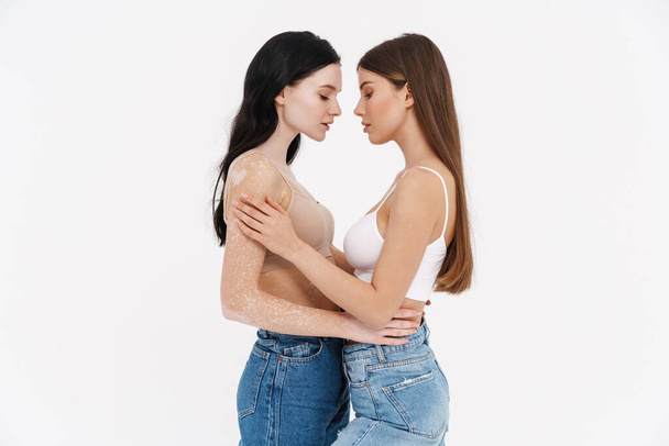 Two young woman in underwear standing together embracing isolated over white background vitiligo skin concept - Фото, зображення