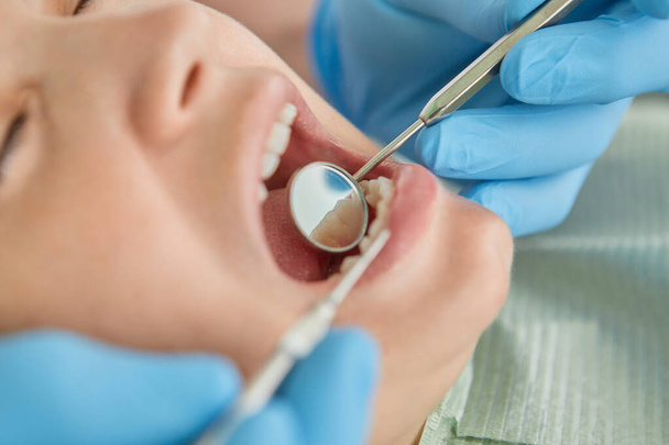 Close-up vrouw die gebit onderzocht tandarts check-up via graafmachine in Clinic haar patiënt voor mooie glimlach - Foto, afbeelding